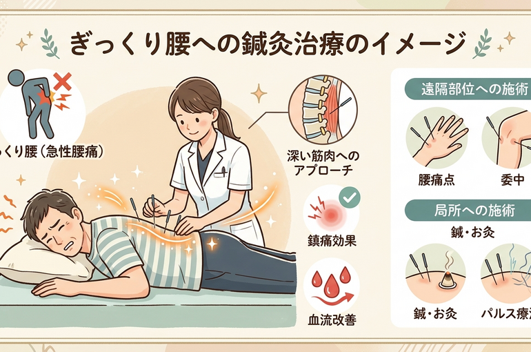    その痛み、我慢しないで！ぎっくり腰に「鍼灸」が効く理由【浅草橋・秋葉原】   