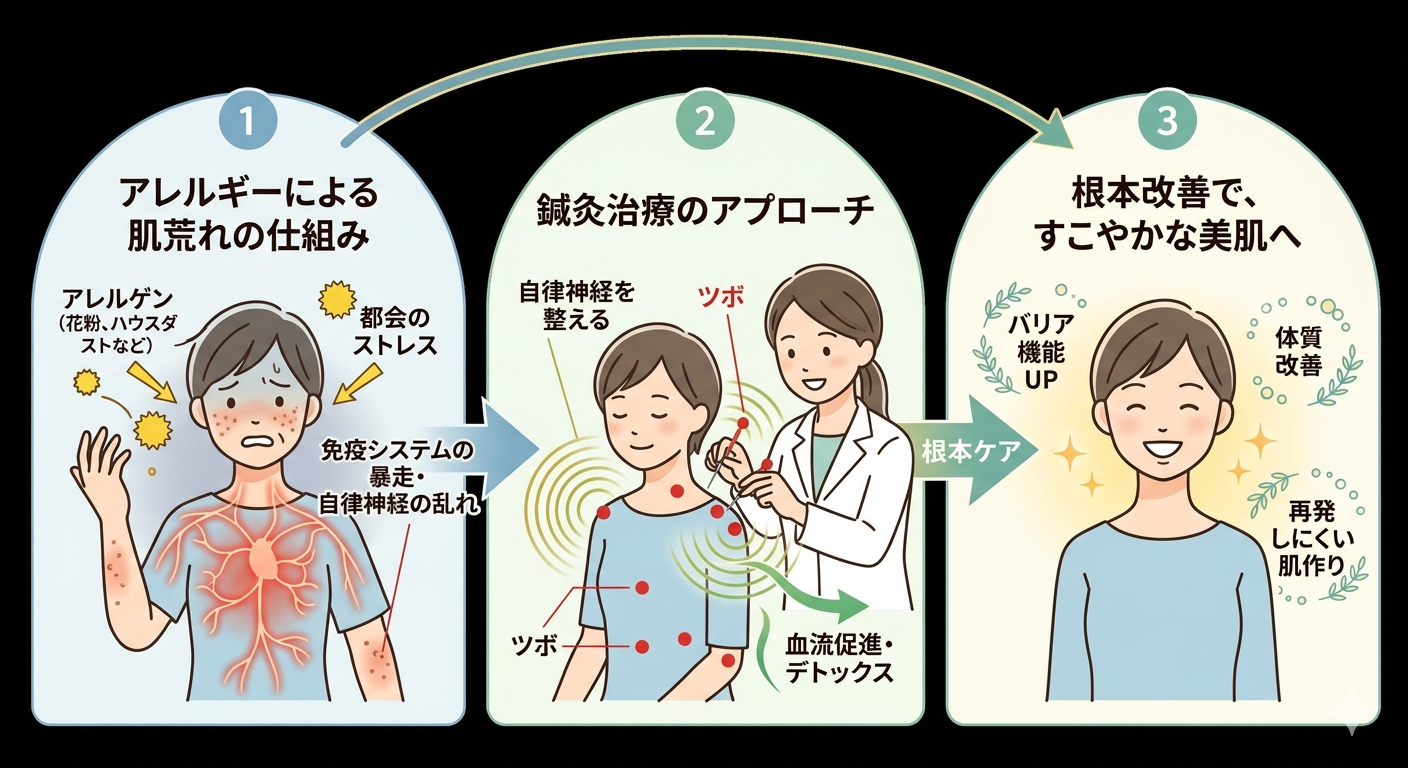 【東京都23区】治らないアレルギー性肌荒れに「鍼灸」が選ばれる理由【秋葉原・浅草橋・馬喰町】