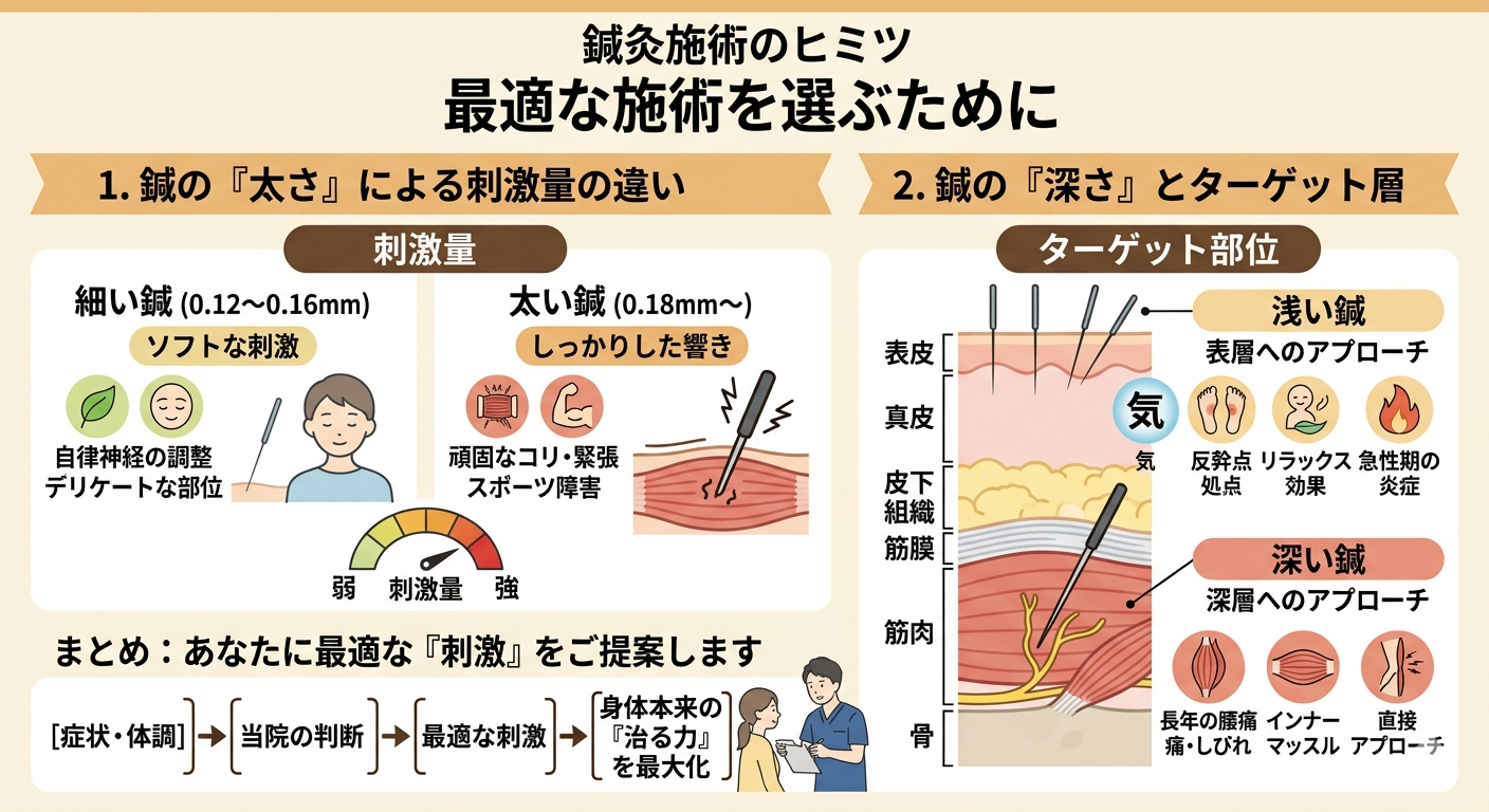 鍼の太さと深さによる効果の違い：専門家が教える症状別の最適解