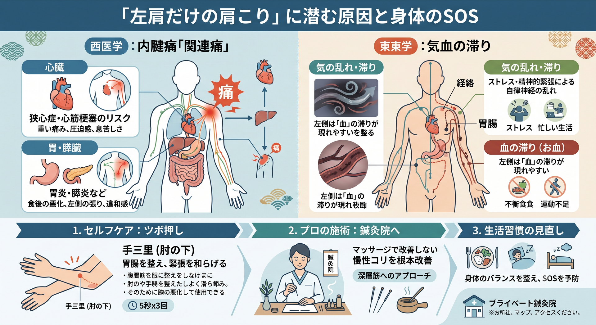 「左肩だけの肩こり」は危険信号？揉んでも治らない原因と鍼灸師が教える対処法