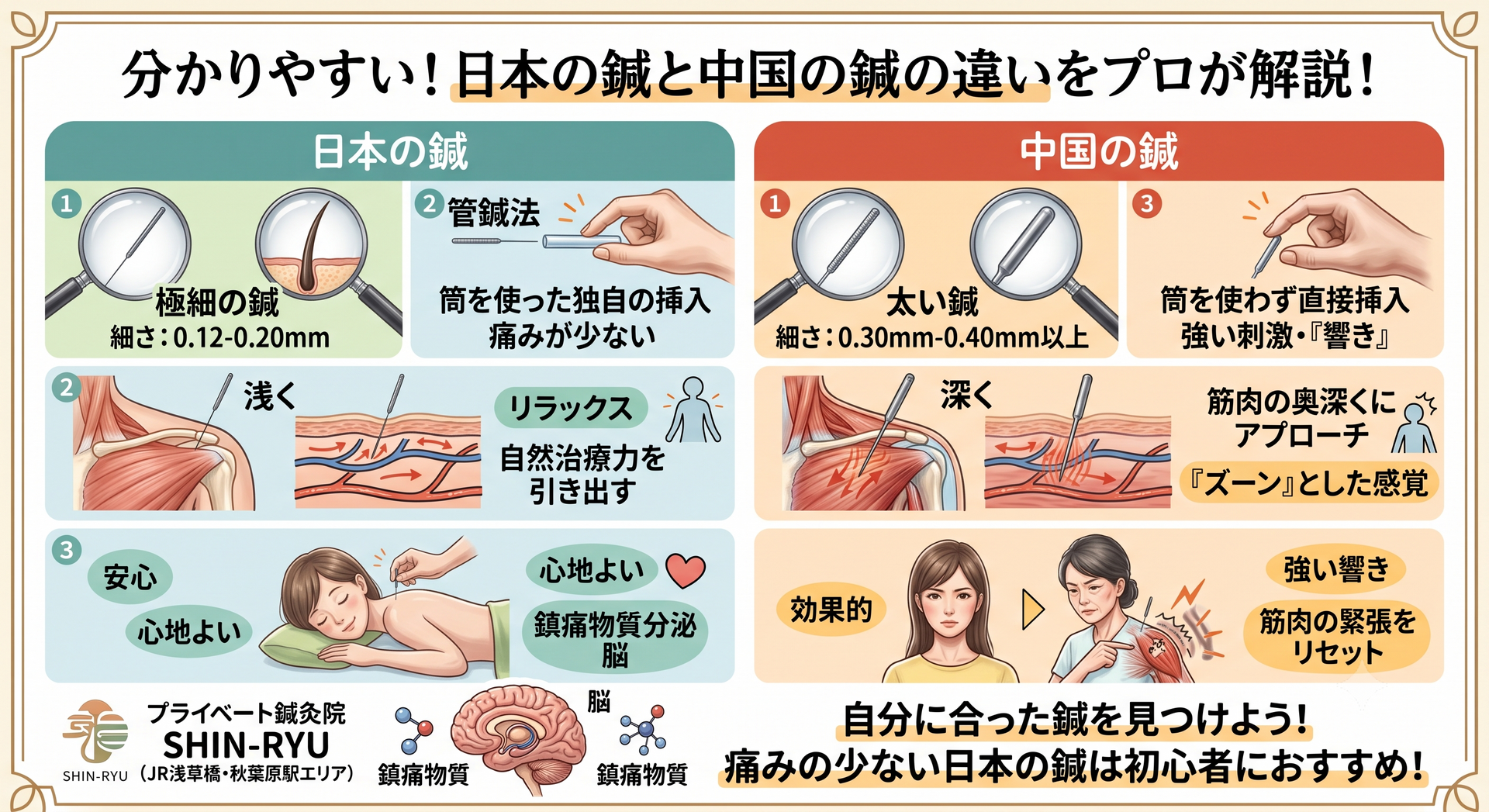 鍼灸治療の疑問を解決！日本の鍼と中国の鍼の違いって？細い鍼でも効果絶大な理由をプロが解説